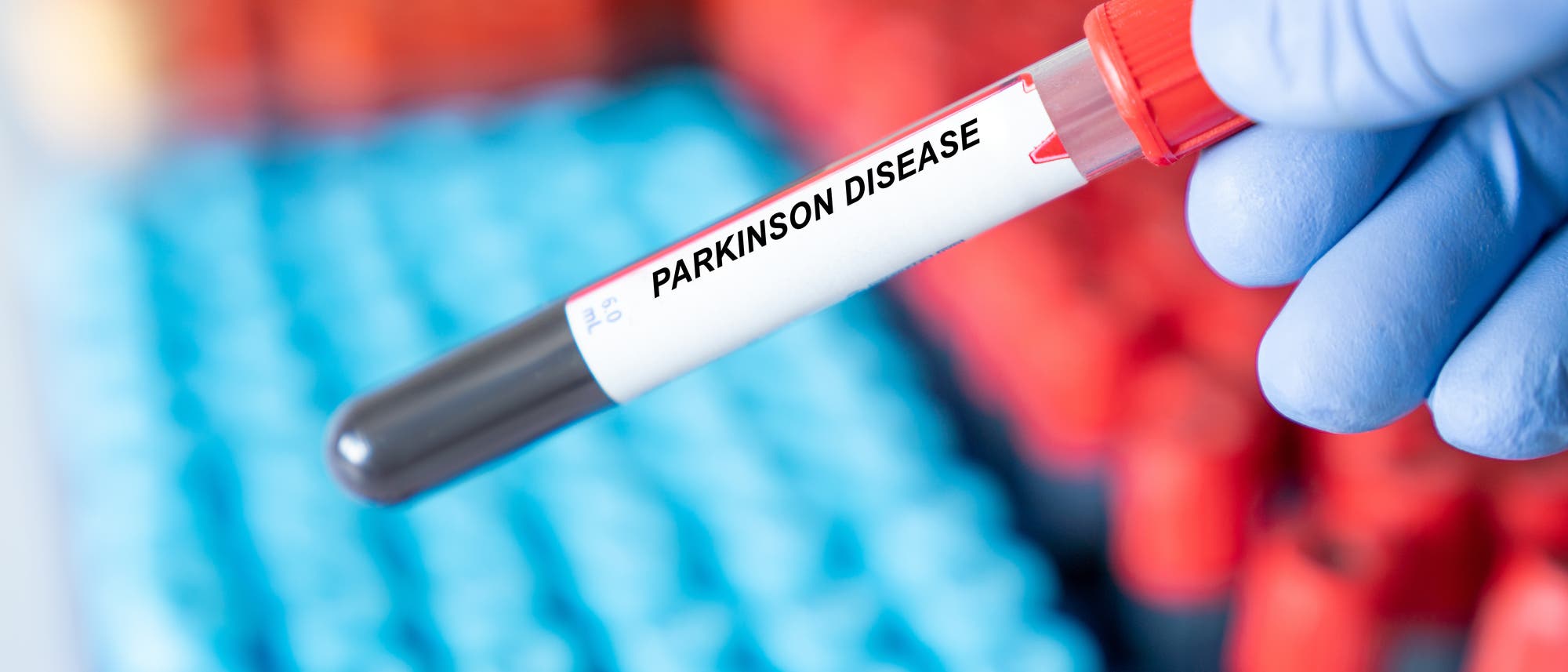 Röhrchen mit einer Blutprobe, die mit »Parkinson Disease« beschriftet ist