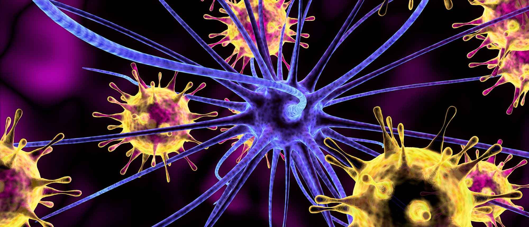 Eine schöne Illustration einer 3-D-Nervenzelle umgeben von fancy 3-D-Viren, bei der leider der nicht unwesentliche Größenunterschied zwischen den beiden unter den Tisch fällt.