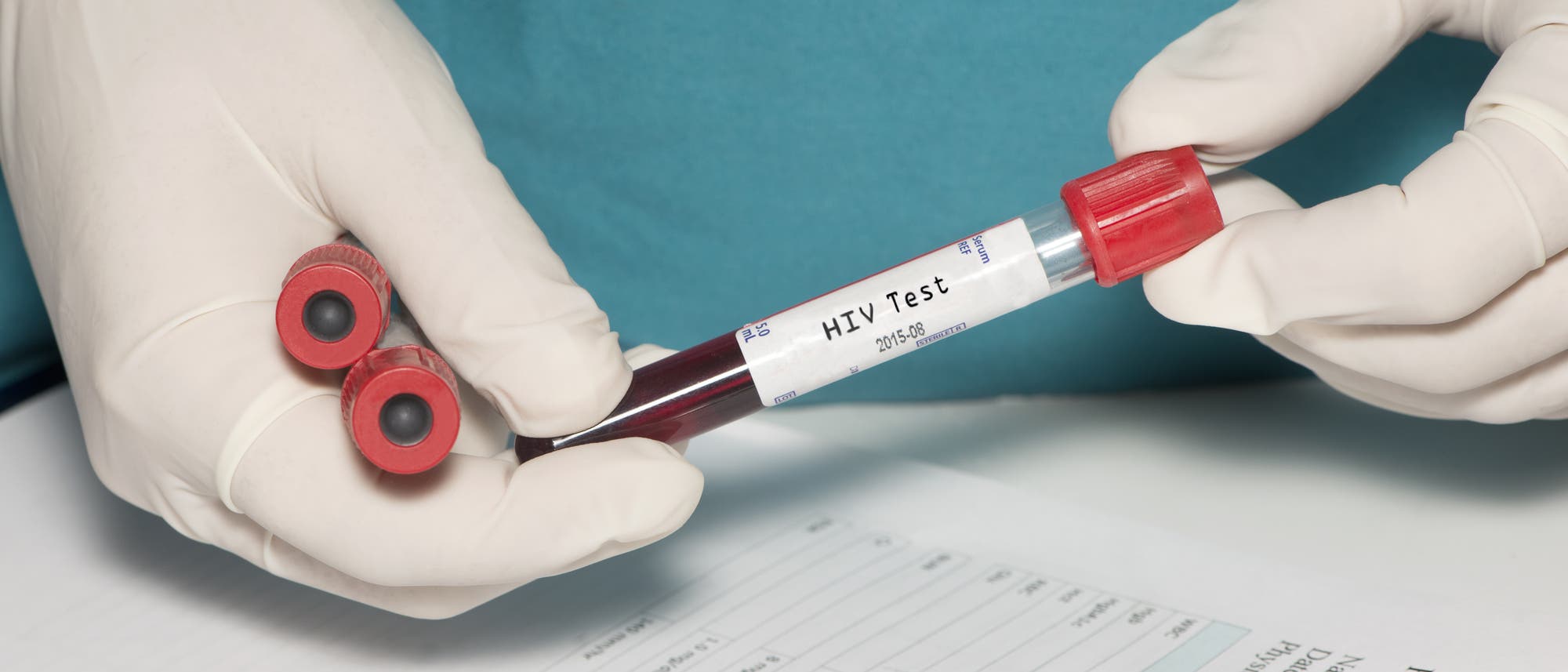Zwei Hände in Handschuhen spielen mit mehrere Ampullen voll Blut herum. Auf einer davon steht "HIV-Test". Mit echten HIV-verdächtigen Blutproben geht man allerdings etwas weniger lässig um.