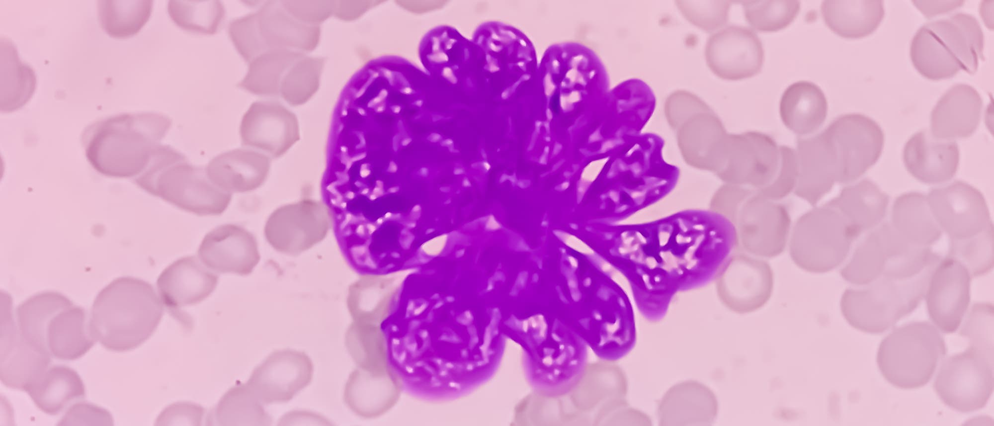 Fluoreszenzmikroskopisches Bild von Zellen, die in verschiedenen Formen und Gr&ouml;&szlig;en erscheinen. Eine zentrale, intensiv gef&auml;rbte Struktur in leuchtendem Violett hebt sich von den umgebenden, blasseren Zellen ab. Der Hintergrund ist in einem weichen Rosa gehalten, was die Kontraste verst&auml;rkt. Das Bild zeigt die detaillierte Zellstruktur und dient der wissenschaftlichen Analyse von Zellmorphologie und -verteilung.