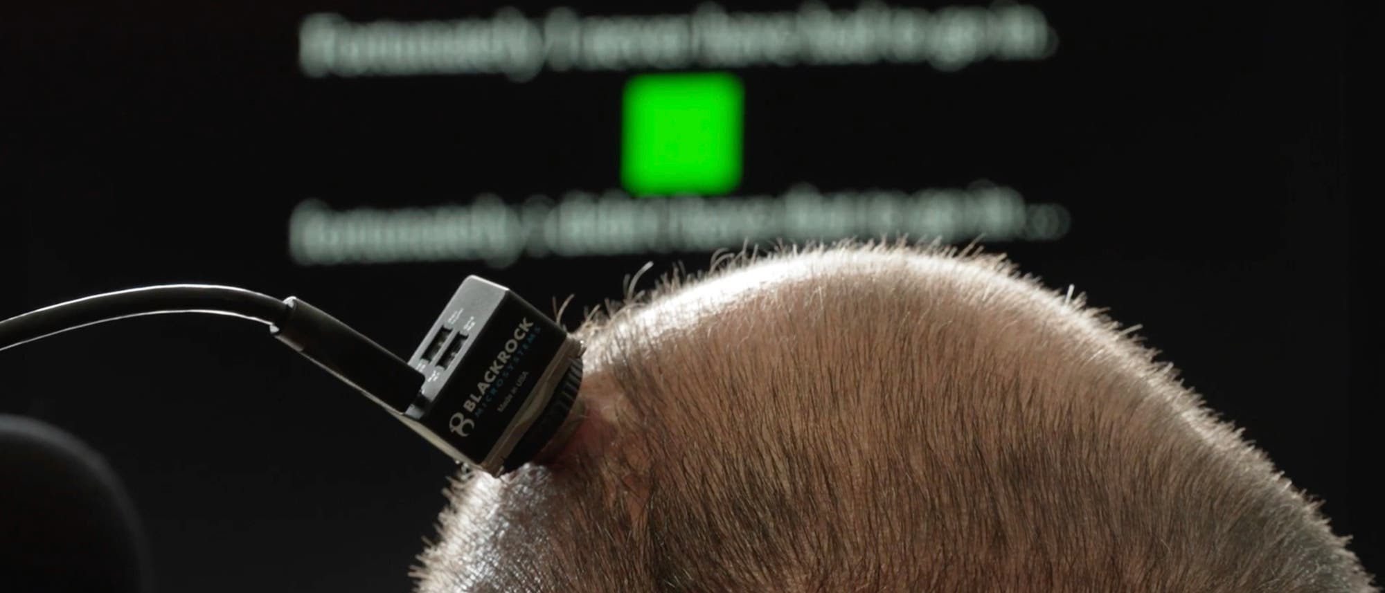 Ein elektronisches Ger&auml;t ist auf dem Kopf einer Person angebracht. Im Hintergrund ist ein unscharfer Bildschirm mit Text und einem gr&uuml;nen Quadrat zu sehen. Das Ger&auml;t tr&auml;gt die Aufschrift "Blackrock Microsystems".