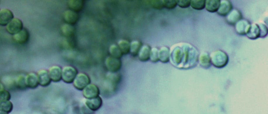 Cyanobakterien der Gattung Nostoc
