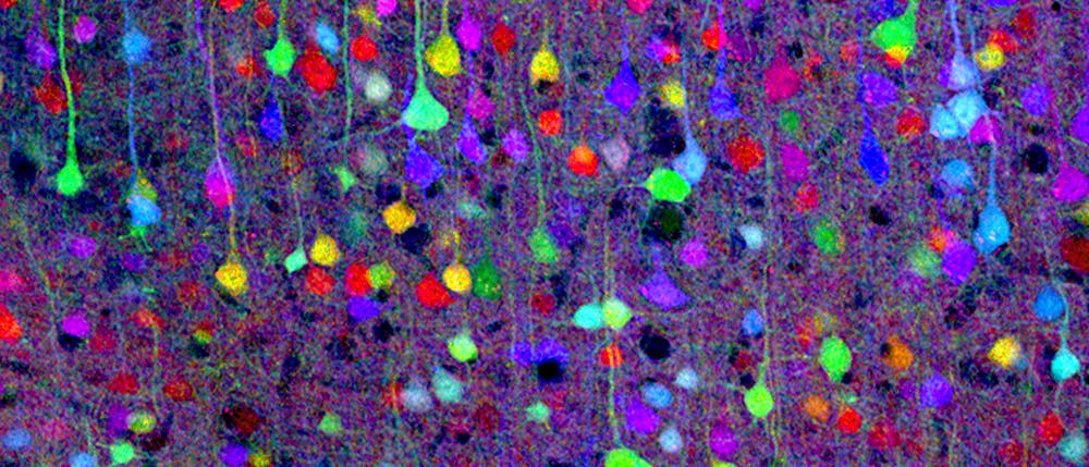 Neurone live und in Farbe