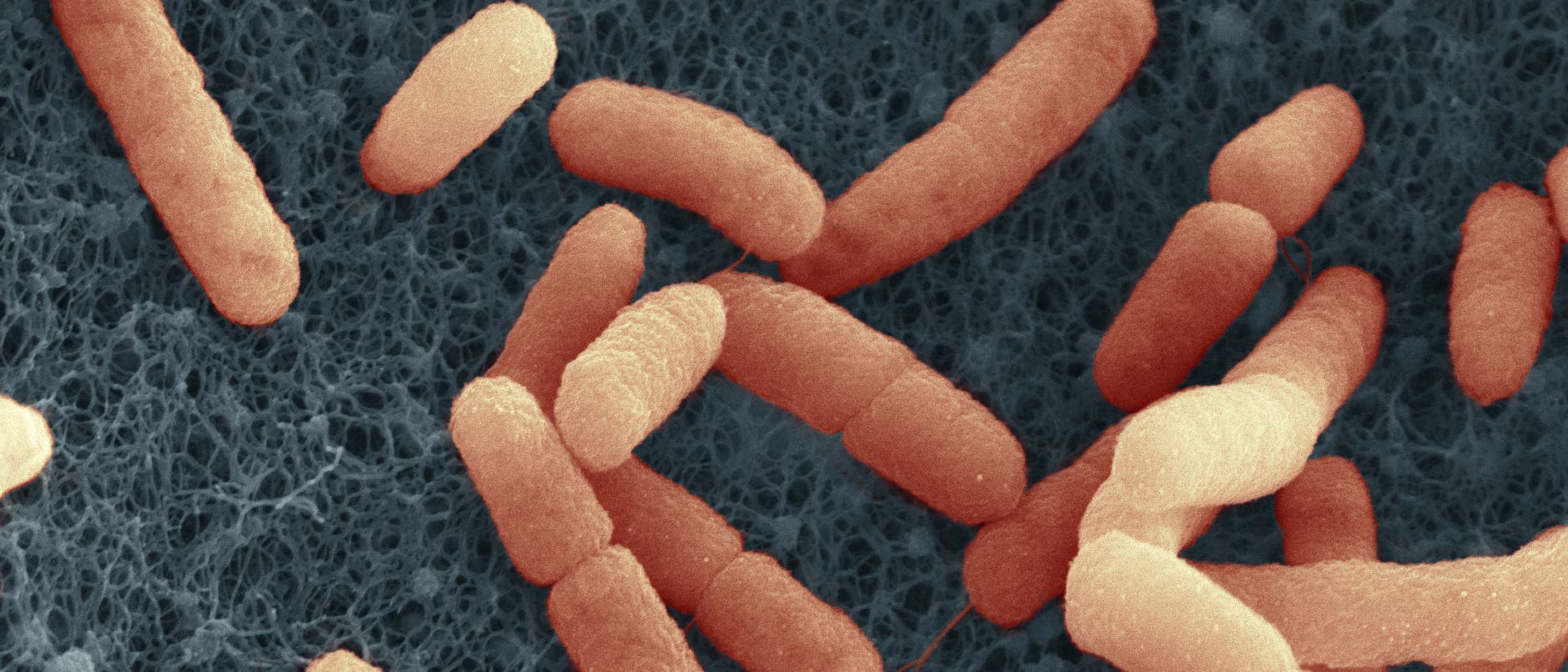 Elektronenmikroskopische Aufnahme von st&auml;bchenf&ouml;rmigen Bakterien auf einer strukturierten Oberfl&auml;che. Die Bakterien sind in einer orangefarbenen F&auml;rbung dargestellt, w&auml;hrend der Hintergrund dunkelgrau ist. Die Aufnahme zeigt die detaillierte Textur der Bakterien und der Oberfl&auml;che. Ein Ma&szlig;stabsbalken ist am unteren Rand sichtbar.