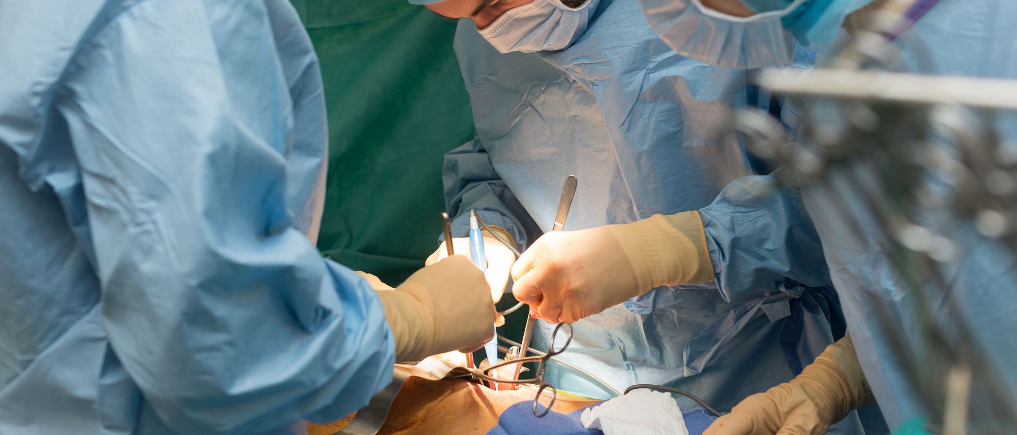 Chirurgisches Team in einem Operationssaal, das konzentriert an einem Patienten arbeitet. Die Ärzte tragen blaue OP-Kleidung, Masken und Handschuhe. Sie verwenden chirurgische Instrumente unter hellem Licht. Der Fokus liegt auf der präzisen Durchführung des Eingriffs. Im Hintergrund sind grüne Abdecktücher zu sehen. Chirurgisches Team in einem Operationssaal, das konzentriert an einem Patienten arbeitet. Die Ärzte tragen blaue OP-Kleidung, Masken und Handschuhe. Sie verwenden chirurgische Instrumente unter hellem Licht. Der Fokus liegt auf der präzisen Durchführung des Eingriffs. Im Hintergrund sind grüne Abdecktücher zu sehen.