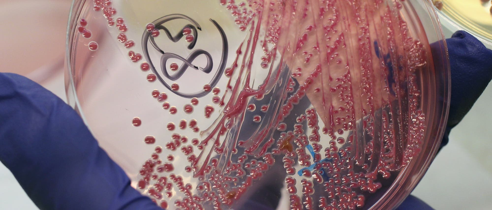 Eine Hand in einem blauen Handschuh hält eine Petrischale mit einer EHEC-Bakterienkultur. Im Hintergrund sieht man in Unschärfe einen typischen Laborhintergrund. Eine Hand in einem blauen Handschuh hält eine Petrischale mit einer EHEC-Bakterienkultur. Im Hintergrund sieht man in Unschärfe einen typischen Laborhintergrund.