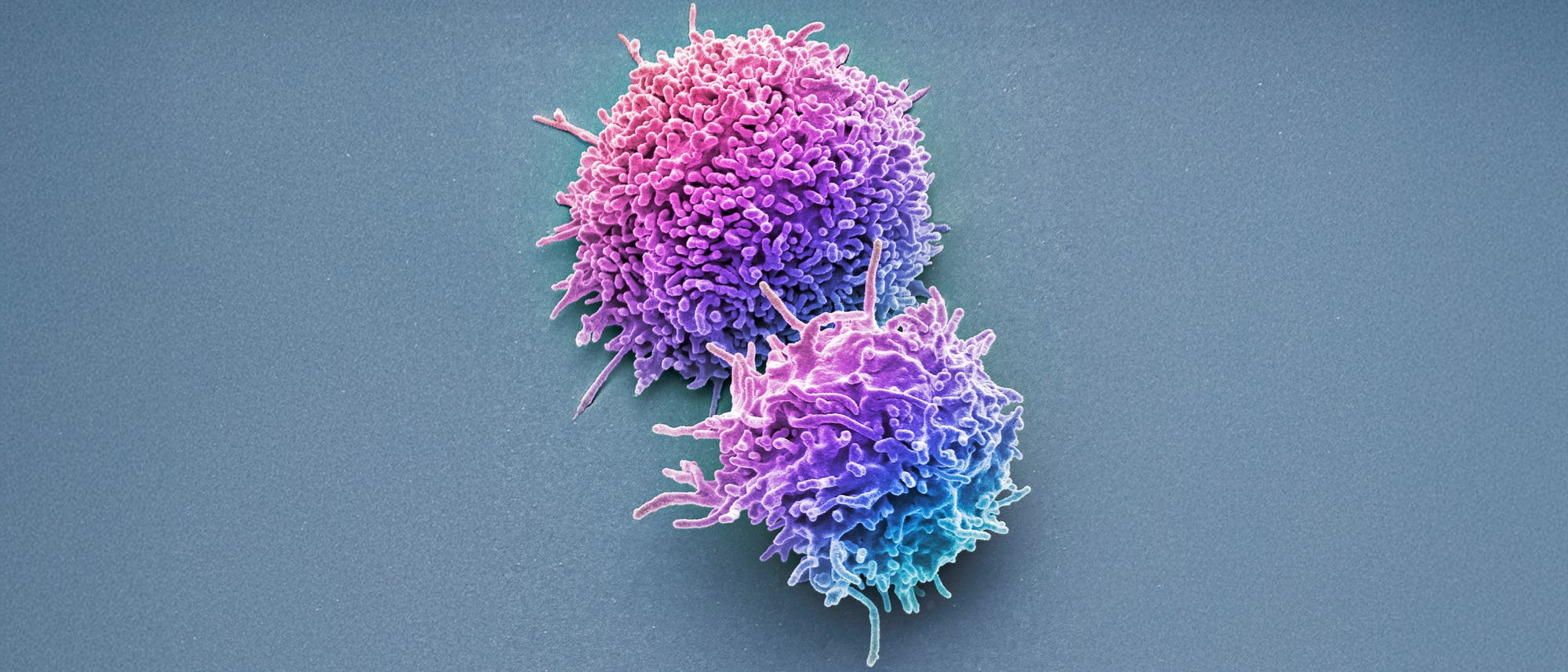 Elektronenmikroskopisches Bild von zwei kugelförmigen Zellen mit unregelmäßiger, stacheliger Oberfläche. Die Zellen sind in lebhaften Violett- und Blautönen dargestellt und heben sich deutlich vom grauen Hintergrund ab. Die Struktur der Zellen zeigt zahlreiche Ausstülpungen und Texturen, die auf die komplexe Zelloberfläche hinweisen.