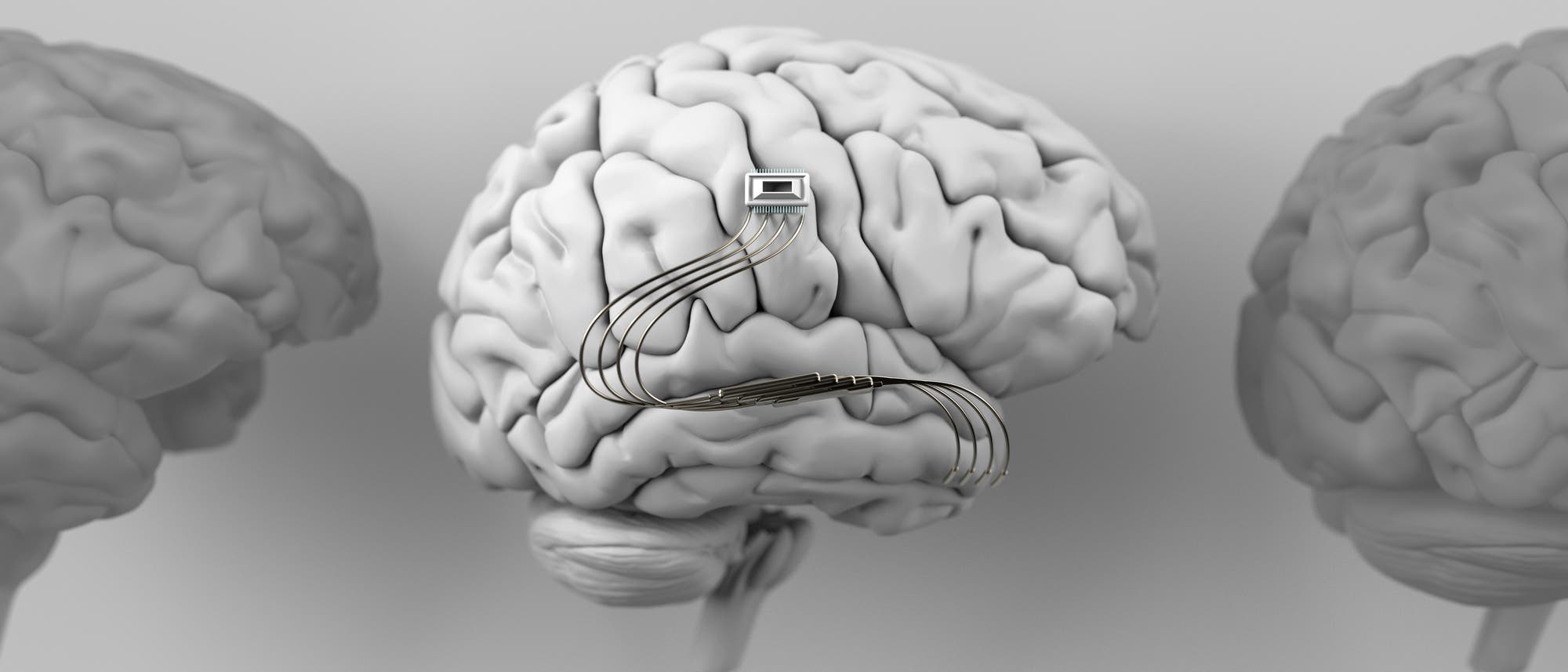 Ein graues 3D-Modell eines menschlichen Gehirns mit einem implantierten elektronischen Gerät, das über mehrere Kabel verbunden ist. Das Gehirn befindet sich in der Mitte des Bildes, flankiert von zwei weiteren Gehirnmodellen im Hintergrund. Die Szene vermittelt den Eindruck von technologischer Integration und Neurotechnologie. Ein graues 3D-Modell eines menschlichen Gehirns mit einem implantierten elektronischen Gerät, das über mehrere Kabel verbunden ist. Das Gehirn befindet sich in der Mitte des Bildes, flankiert von zwei weiteren Gehirnmodellen im Hintergrund. Die Szene vermittelt den Eindruck von technologischer Integration und Neurotechnologie.