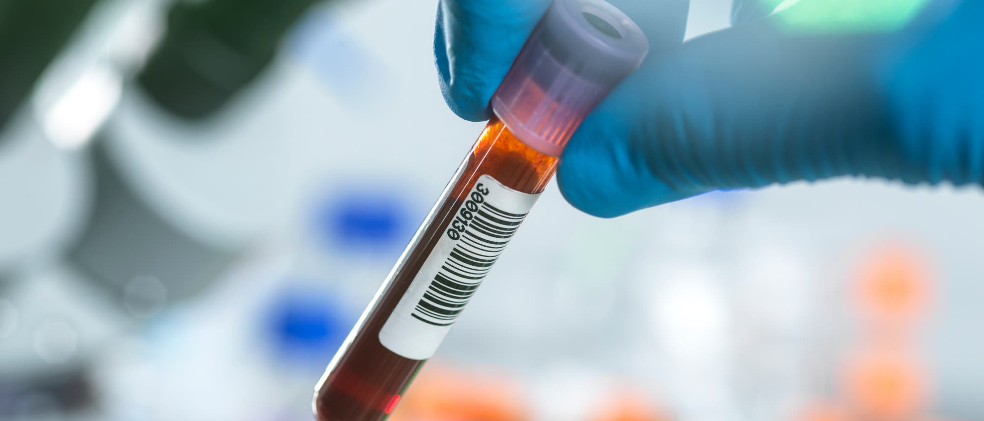 Eine Hand hält ein Reagenzglas mit einer Blutprobe. Im Hintergrund sind unscharfe Laborgeräte zu sehen.