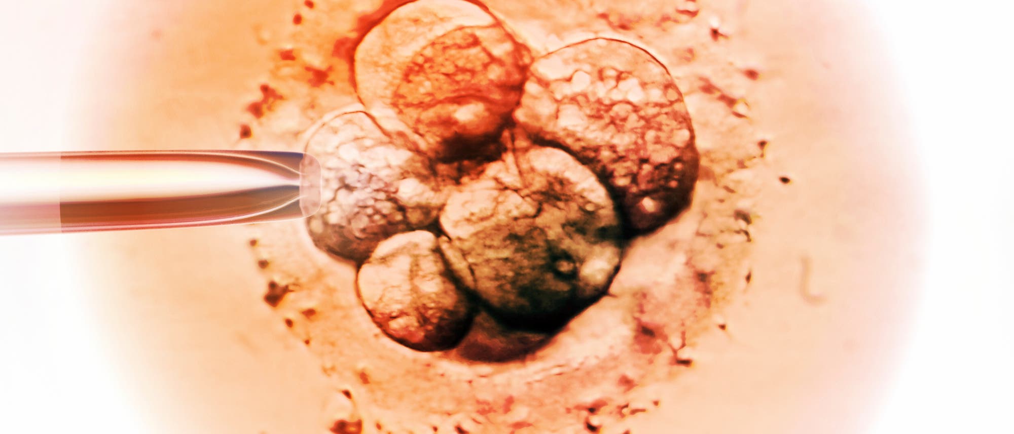 Mikroskopische Aufnahme eines Embryos im frühen Zellstadium. Eine feine Glaspipette ist links im Bild zu sehen, die möglicherweise für eine In-vitro-Fertilisation oder Zellmanipulation verwendet wird. Die Zellen sind kugelförmig und eng beieinander angeordnet, umgeben von einer transparenten Membran. Die Struktur und Anordnung der Zellen sind deutlich erkennbar.