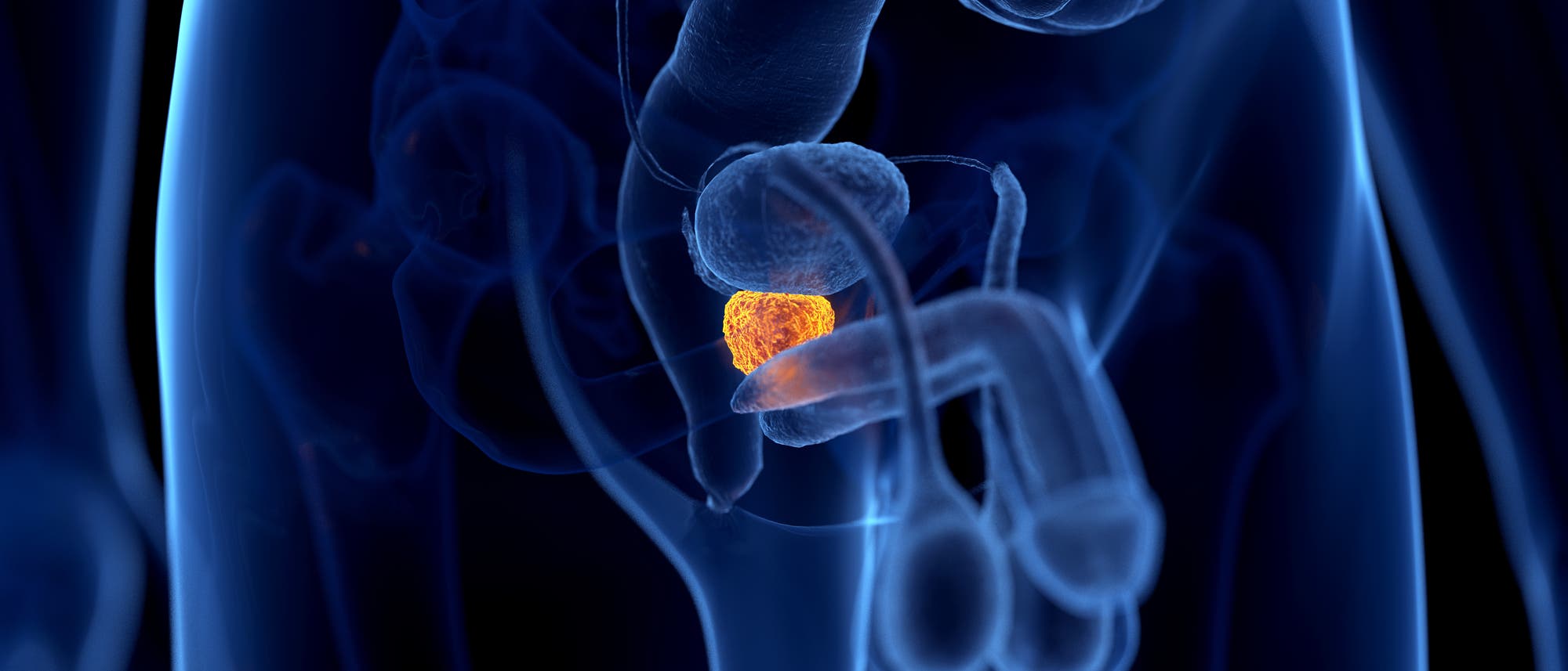 Schematische Darstellung der Prostata im Unterleib eines Mannes. Schematische Darstellung der Prostata im Unterleib eines Mannes.