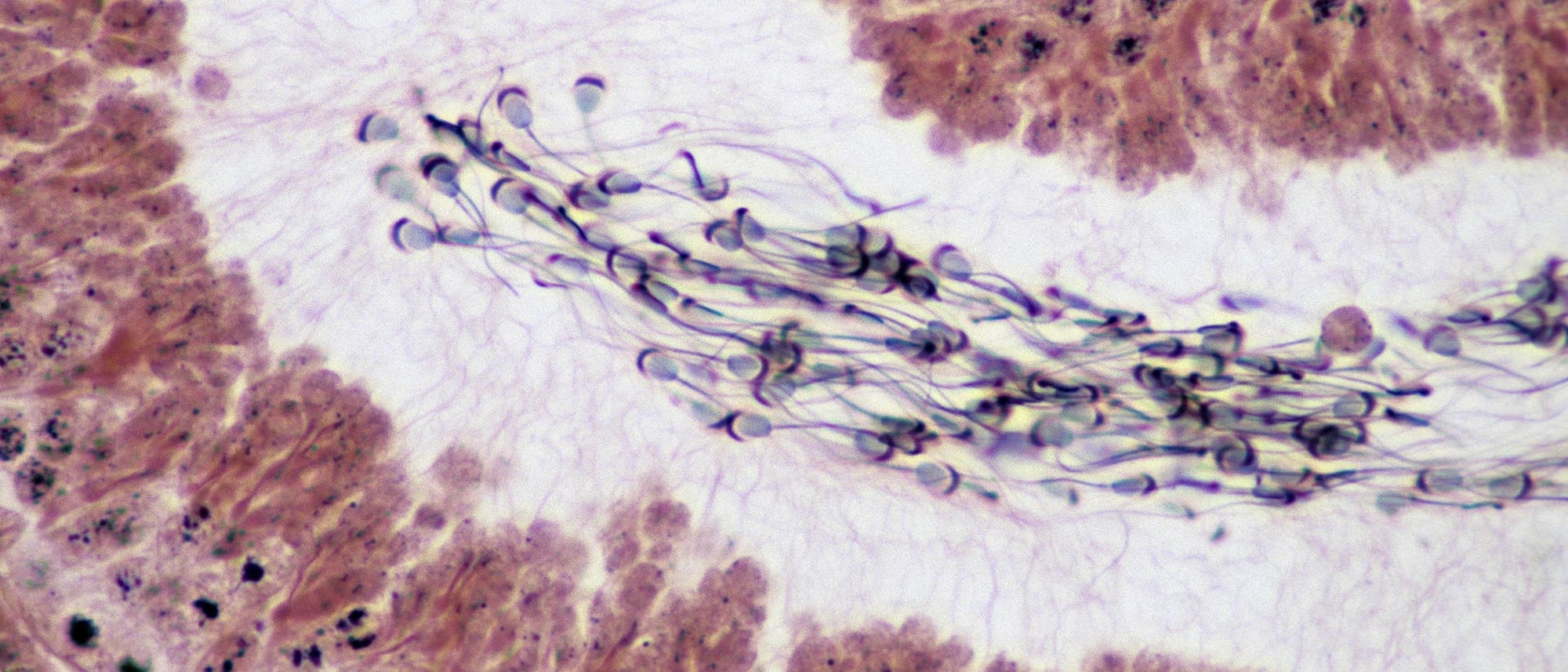 Mikroskopische Aufnahme von Spermien in einem Gewebequerschnitt. Die Spermien sind dunkel gefärbt und heben sich deutlich vom umgebenden Gewebe ab, das in verschiedenen Brauntönen erscheint. Die Struktur des Gewebes zeigt eine dichte Anordnung von Zellen, während die Spermien in einem zentralen Bereich konzentriert sind. Mikroskopische Aufnahme von Spermien in einem Gewebequerschnitt. Die Spermien sind dunkel gefärbt und heben sich deutlich vom umgebenden Gewebe ab, das in verschiedenen Brauntönen erscheint. Die Struktur des Gewebes zeigt eine dichte Anordnung von Zellen, während die Spermien in einem zentralen Bereich konzentriert sind.