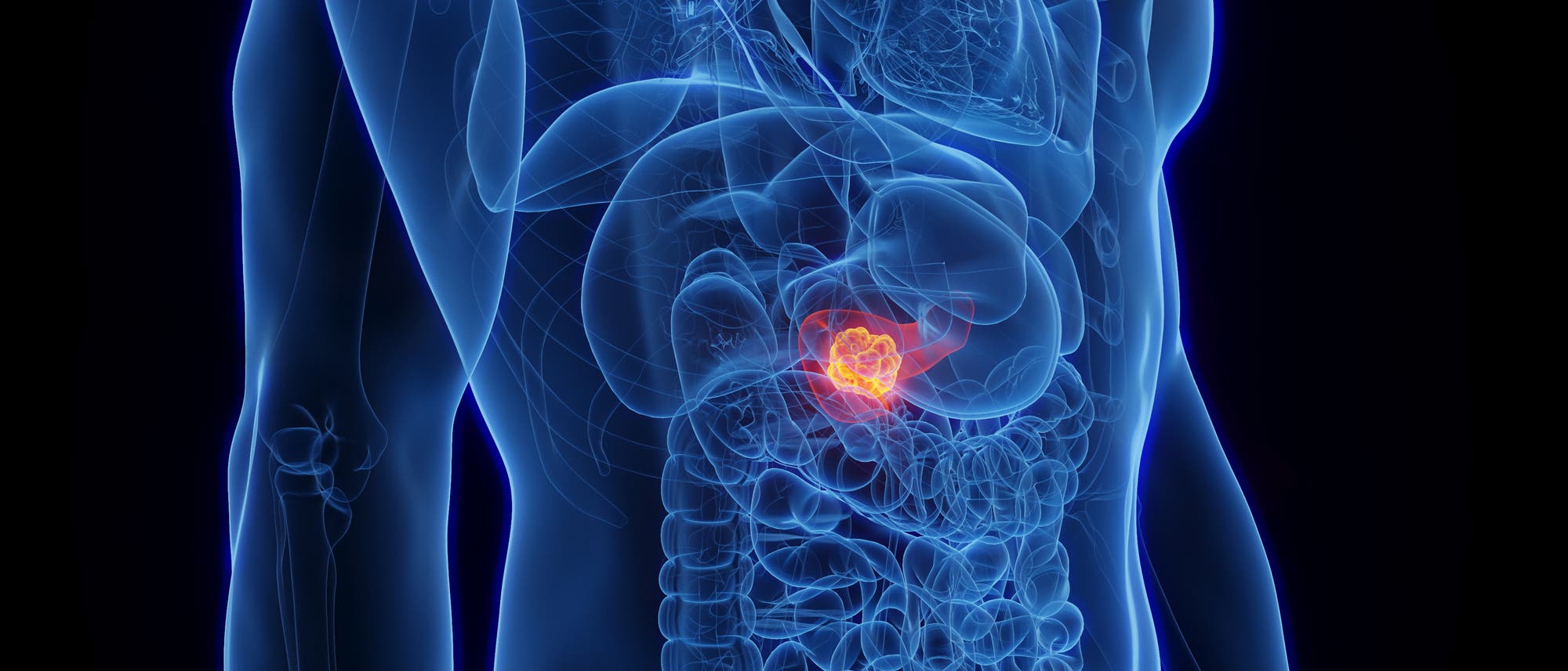 Ein anatomisches Diagramm eines menschlichen Körpers, das den Oberkörper in seitlicher Ansicht zeigt. Die inneren Organe sind transparent dargestellt, wobei ein Bereich im Bauchraum hervorgehoben ist. Dieser Bereich ist in leuchtendem Rot markiert, um eine spezifische Stelle oder ein Organ zu betonen. Das Bild dient der Veranschaulichung der Lage und Struktur der inneren Organe im menschlichen Körper. Ein anatomisches Diagramm eines menschlichen Körpers, das den Oberkörper in seitlicher Ansicht zeigt. Die inneren Organe sind transparent dargestellt, wobei ein Bereich im Bauchraum hervorgehoben ist. Dieser Bereich ist in leuchtendem Rot markiert, um eine spezifische Stelle oder ein Organ zu betonen. Das Bild dient der Veranschaulichung der Lage und Struktur der inneren Organe im menschlichen Körper.