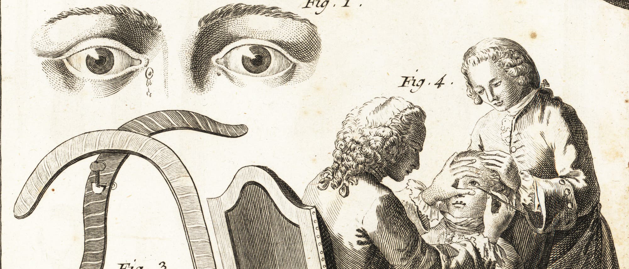 Eine historische Skizze zeigt eine medizinische Prozedur. Zwei Personen in historischer Kleidung f&uuml;hren eine Augenbehandlung an einer dritten Person durch, die auf einem Stuhl sitzt. Oberhalb der Szene sind detaillierte Zeichnungen von Augen zu sehen. Links im Bild sind medizinische Instrumente abgebildet. Die Skizze vermittelt einen Einblick in historische medizinische Praktiken.