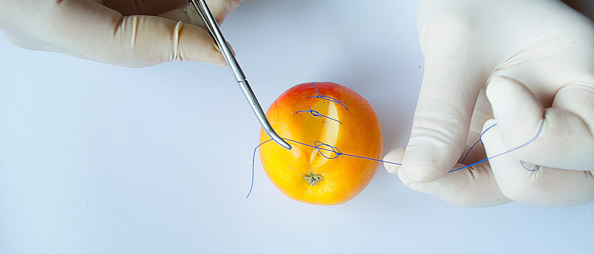 Zwei Hände in weißen Handschuhen vernähen mit einem blauem Faden einen Spalt in einem Apfel. Die Szene zeigt eine Übung zur Nahttechnik, die in medizinischen Schulungen verwendet wird. Zwei Hände in weißen Handschuhen vernähen mit einem blauem Faden einen Spalt in einem Apfel. Die Szene zeigt eine Übung zur Nahttechnik, die in medizinischen Schulungen verwendet wird.