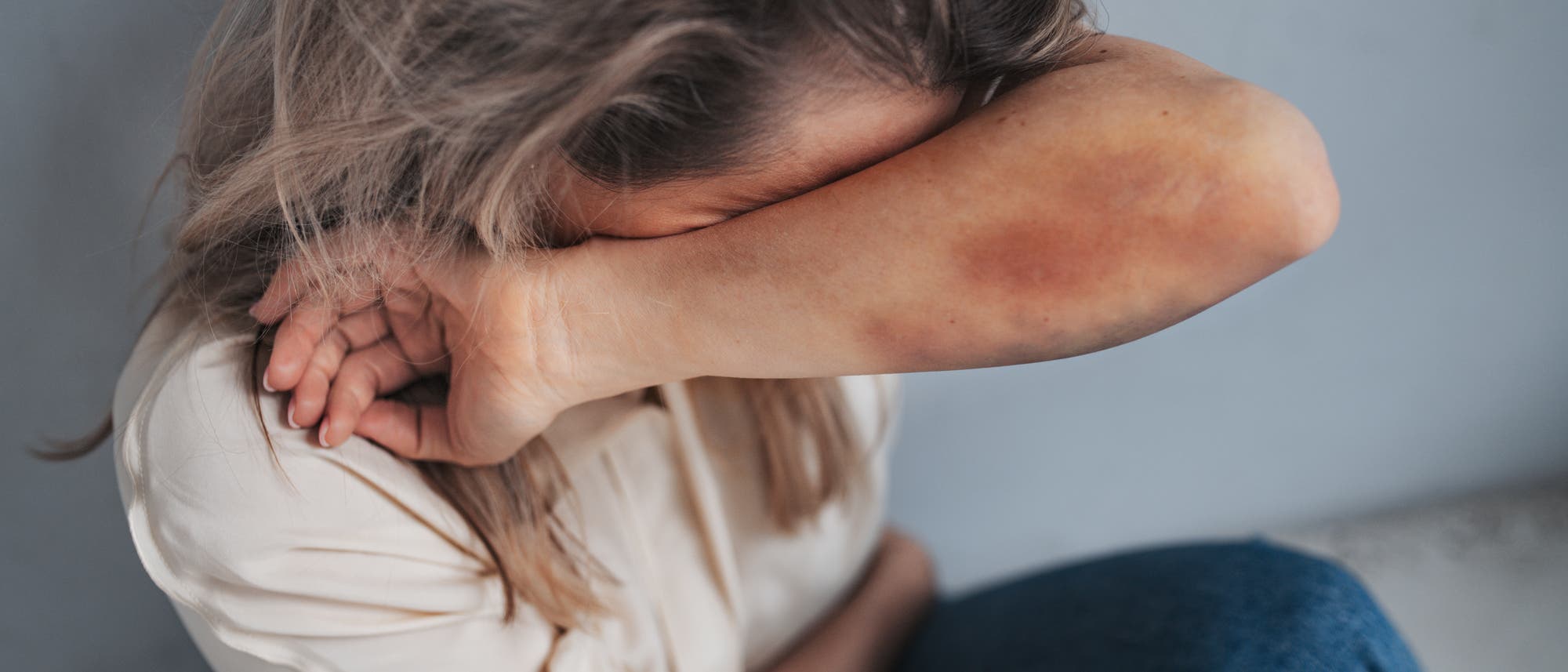 Eine Person sitzt mit angewinkelten Beinen und verbirgt ihr Gesicht in ihrem Arm. Der Arm zeigt sichtbare blaue Flecken. Die Person trägt ein helles Oberteil und Jeans. Die Szene vermittelt einen emotionalen Ausdruck von Schutz oder Traurigkeit.