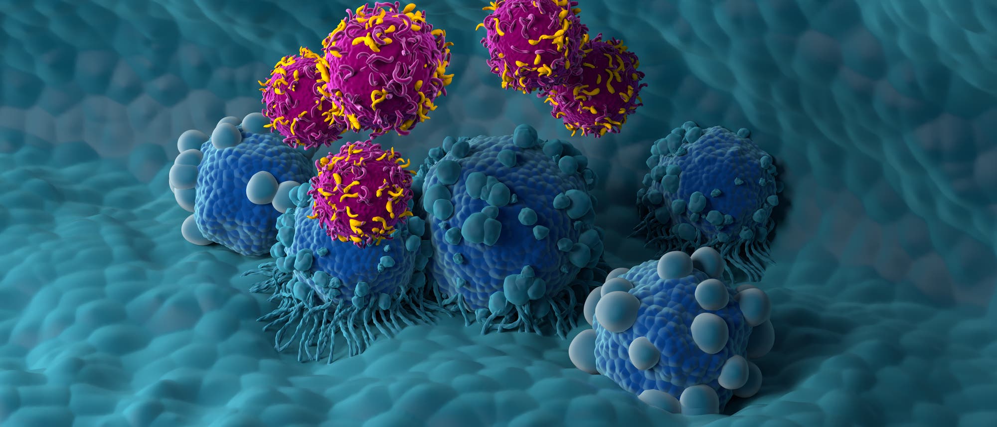 3D-Darstellung von Immunzellen, die Krebszellen angreifen. Die blauen Zellen repr&auml;sentieren Krebszellen, w&auml;hrend die pinkfarbenen Zellen mit gelben Strukturen Immunzellen darstellen. Die Szene zeigt die Interaktion zwischen den Zellen auf einer blauen, unregelm&auml;&szlig;igen Oberfl&auml;che, die das Gewebe symbolisiert.
