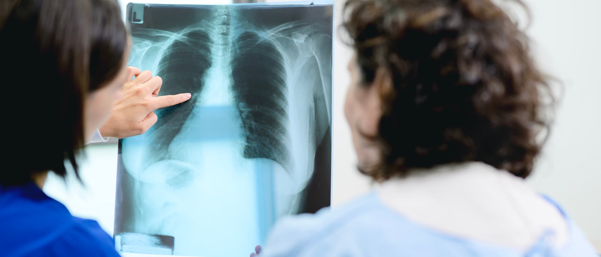 Eine &Auml;rztin zeigt einer Patientin ein R&ouml;ntgenbild des Brustkorbs. Die &Auml;rztin deutet auf einen Bereich des Bildes, w&auml;hrend die Patientin aufmerksam zuh&ouml;rt. Das Bild zeigt die Struktur der Rippen und Lungen. Es findet in einem hellen Raum statt, der auf eine medizinische Umgebung hinweist.