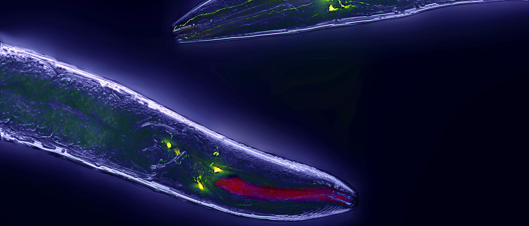 Fadenwurm (Caenorhabditis elegans) mit grün eingefärbten Neuronen