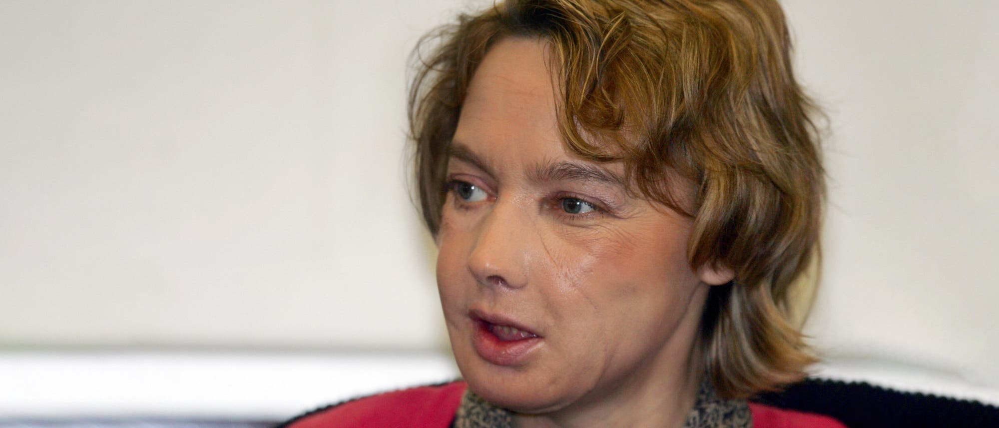 Isabelle Dinoire bei einer Pressekonferenz im Universit&auml;tsklinikum Amiens.