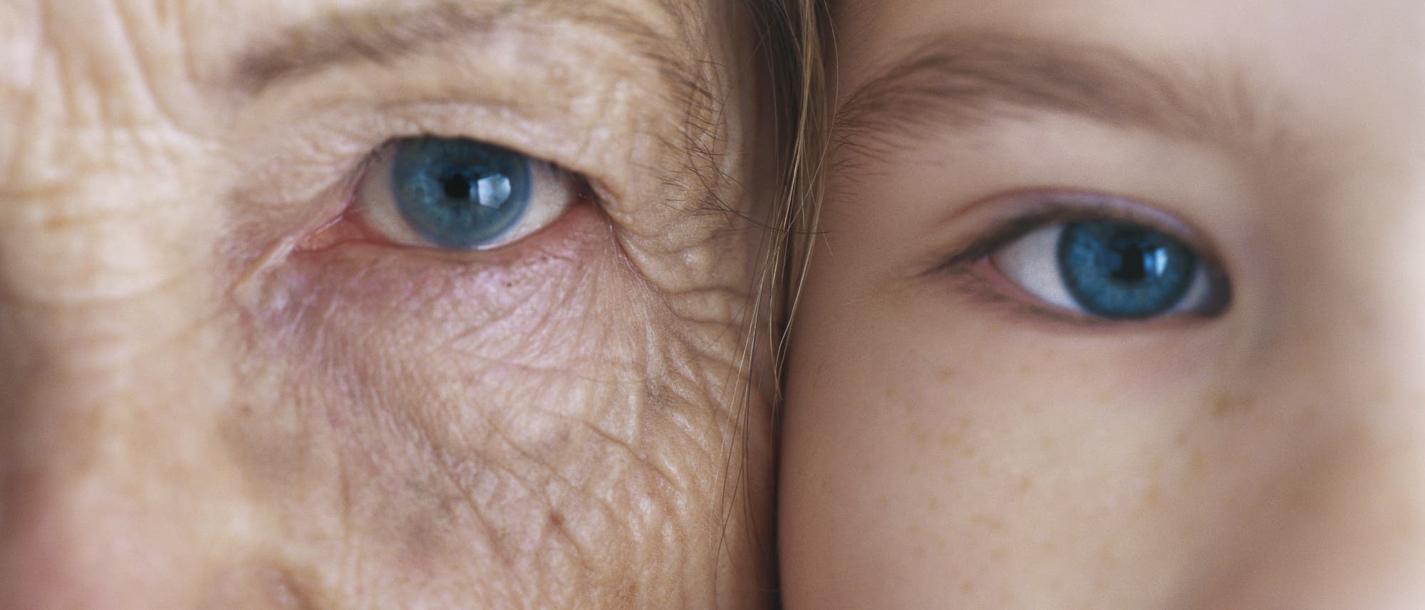 Nahaufnahme von zwei Gesichtern, die nebeneinander gezeigt werden. Links ist ein &auml;lteres Gesicht mit einem blauen Auge, rechts ein j&uuml;ngeres Gesicht ebenfalls mit einem blauen Auge. Das Bild zeigt den Kontrast zwischen Alter und Jugend.