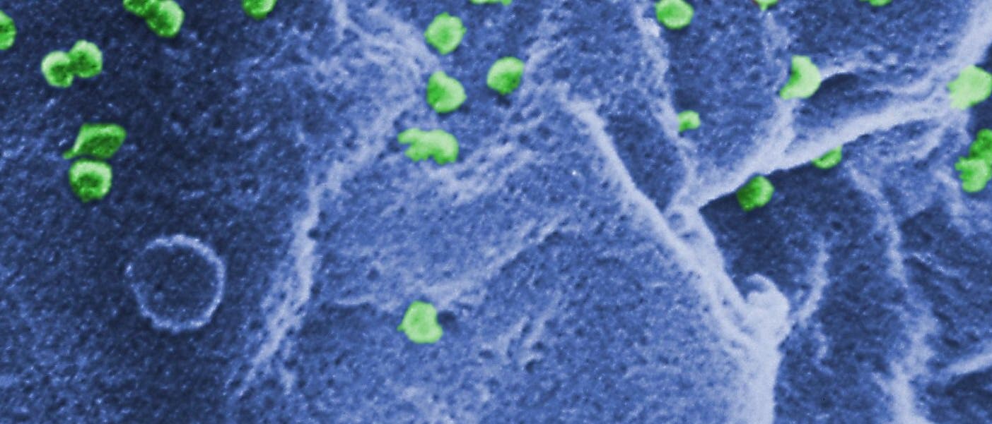HI-Viren knospen aus einer T-Zelle