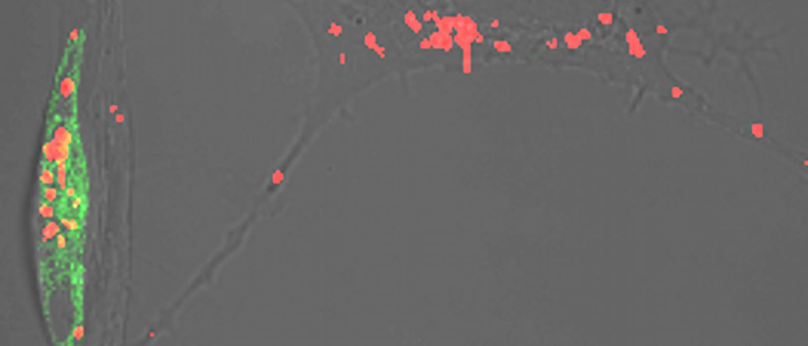 beta-Amyloid in Neuronen