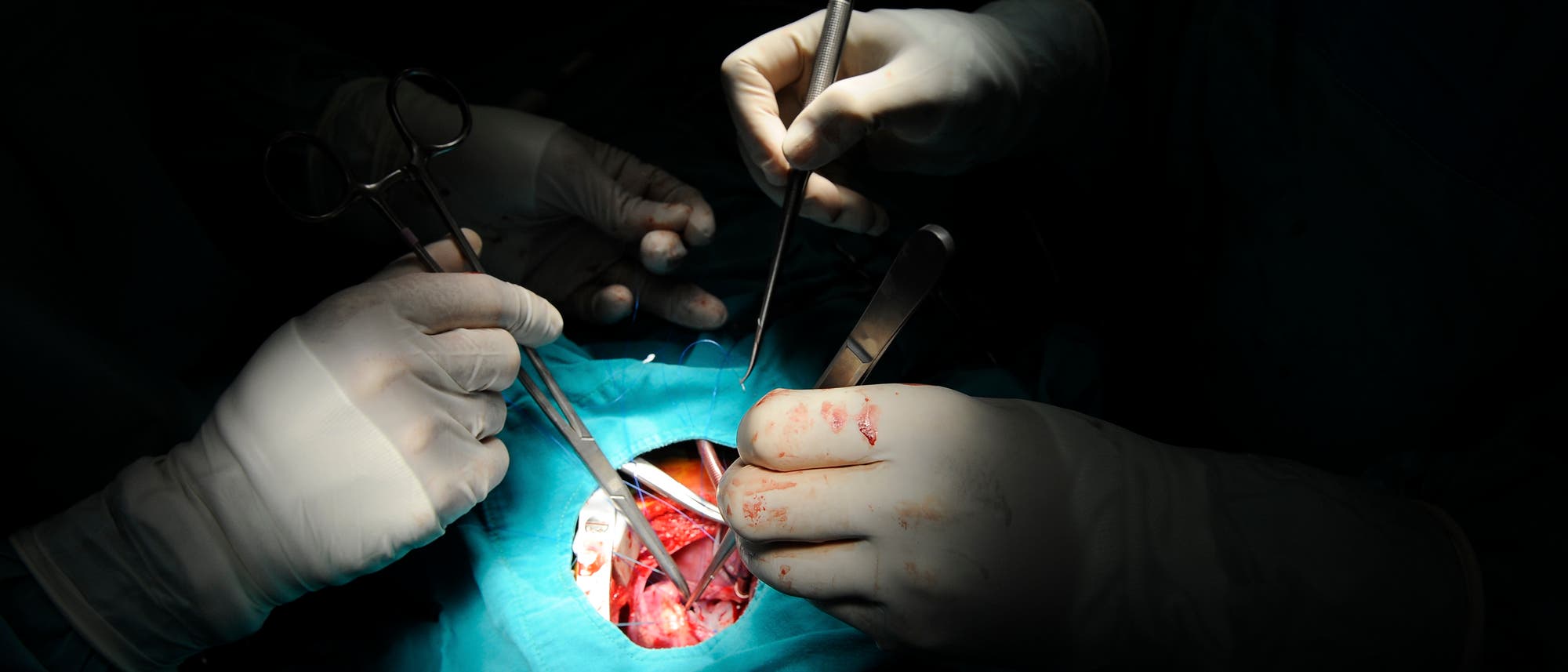 Operation am Herzen
