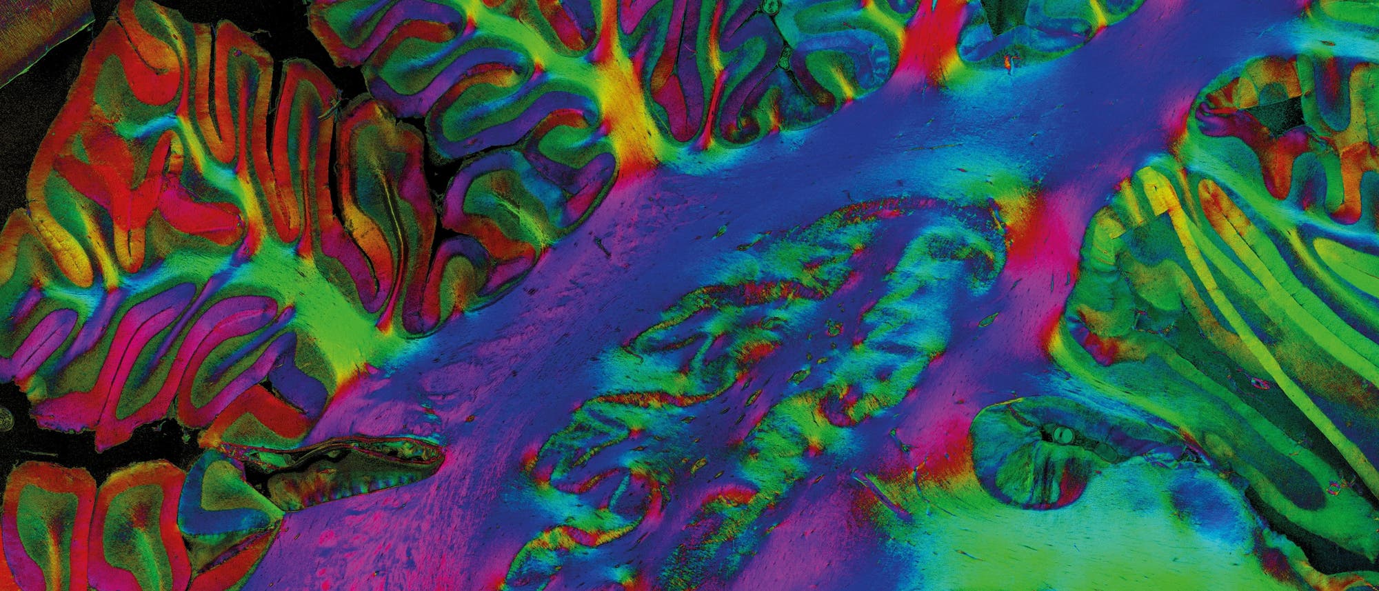 Fluoreszenzmikroskopisches Bild eines Gewebeschnitts in leuchtenden Farben. Die Struktur zeigt komplexe, verzweigte Muster in Grün-, Blau-, Rot- und Violetttönen, die die unterschiedlichen Zelltypen und -strukturen hervorheben. Die kontrastreichen Farben betonen die Details der Gewebemorphologie und ermöglichen eine klare Unterscheidung der verschiedenen Bereiche. Fluoreszenzmikroskopisches Bild eines Gewebeschnitts in leuchtenden Farben. Die Struktur zeigt komplexe, verzweigte Muster in Grün-, Blau-, Rot- und Violetttönen, die die unterschiedlichen Zelltypen und -strukturen hervorheben. Die kontrastreichen Farben betonen die Details der Gewebemorphologie und ermöglichen eine klare Unterscheidung der verschiedenen Bereiche.