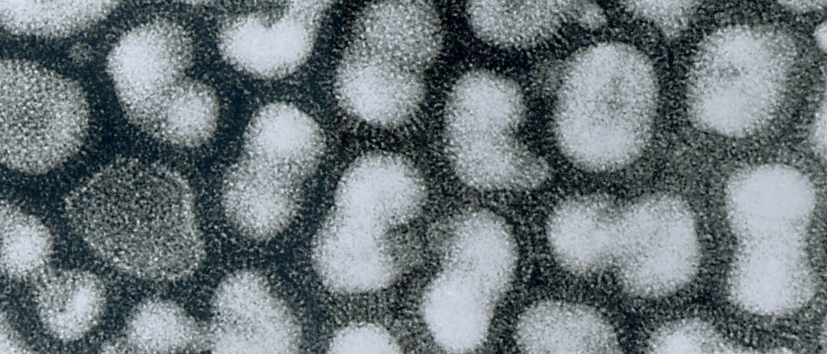 Vogelgrippe: H5N1-Viren