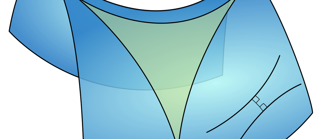 Hyperbolisches Dreieck