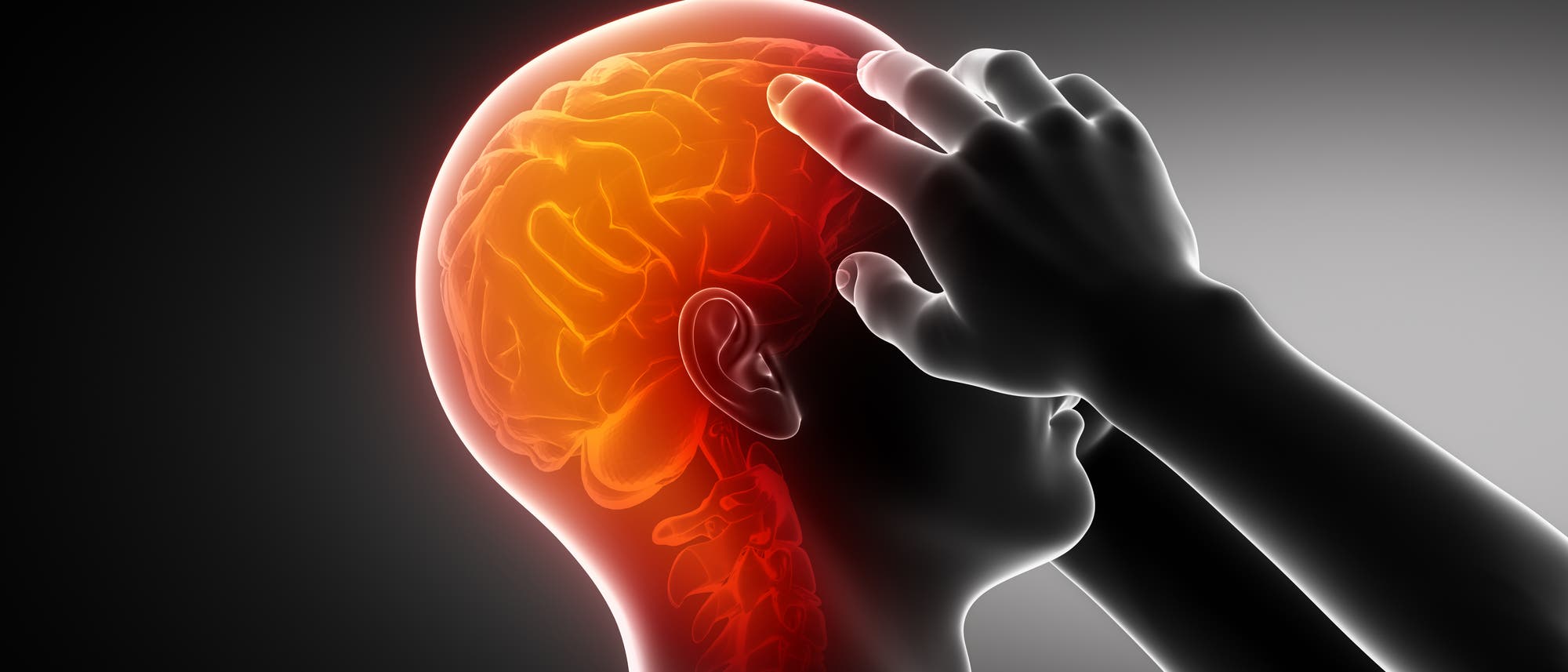 Migräne geht mit starken Kopfschmerzen einher