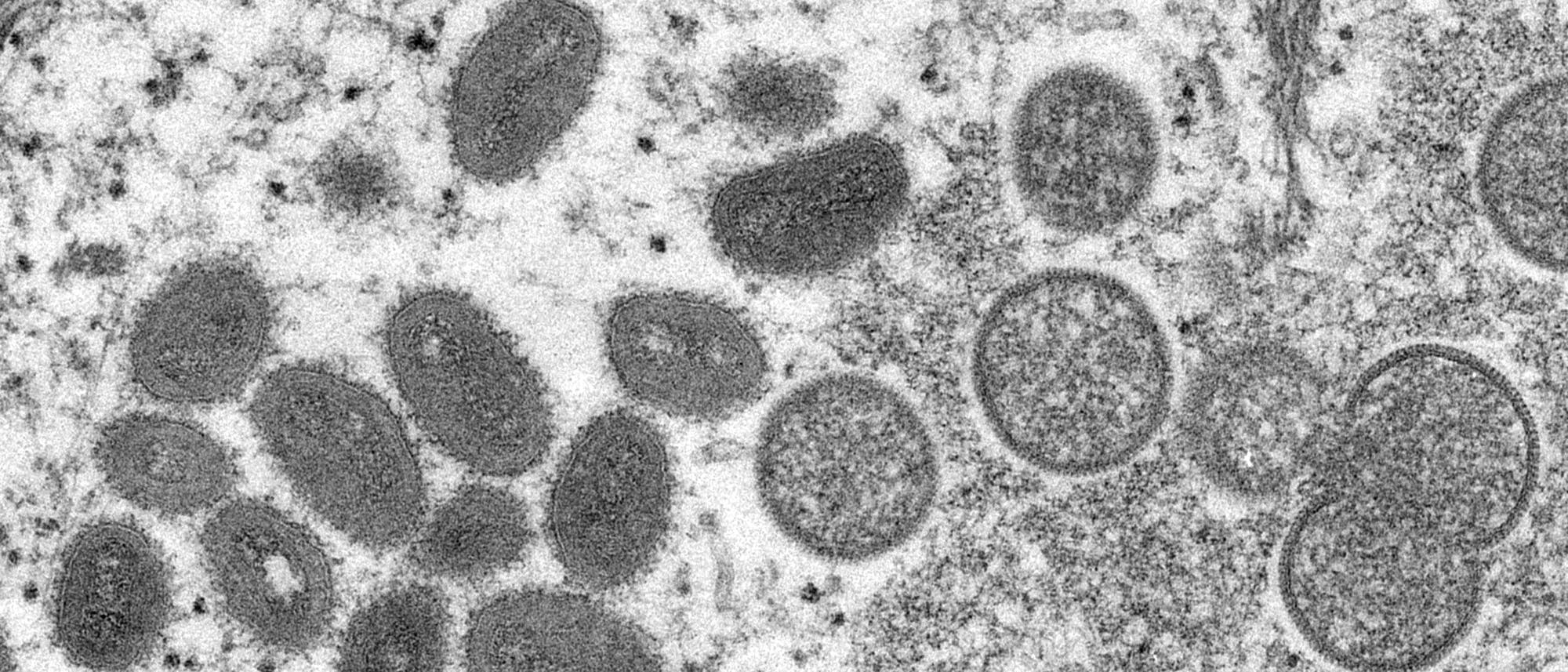 Reife (links) und heranreifende Affenpockenviren