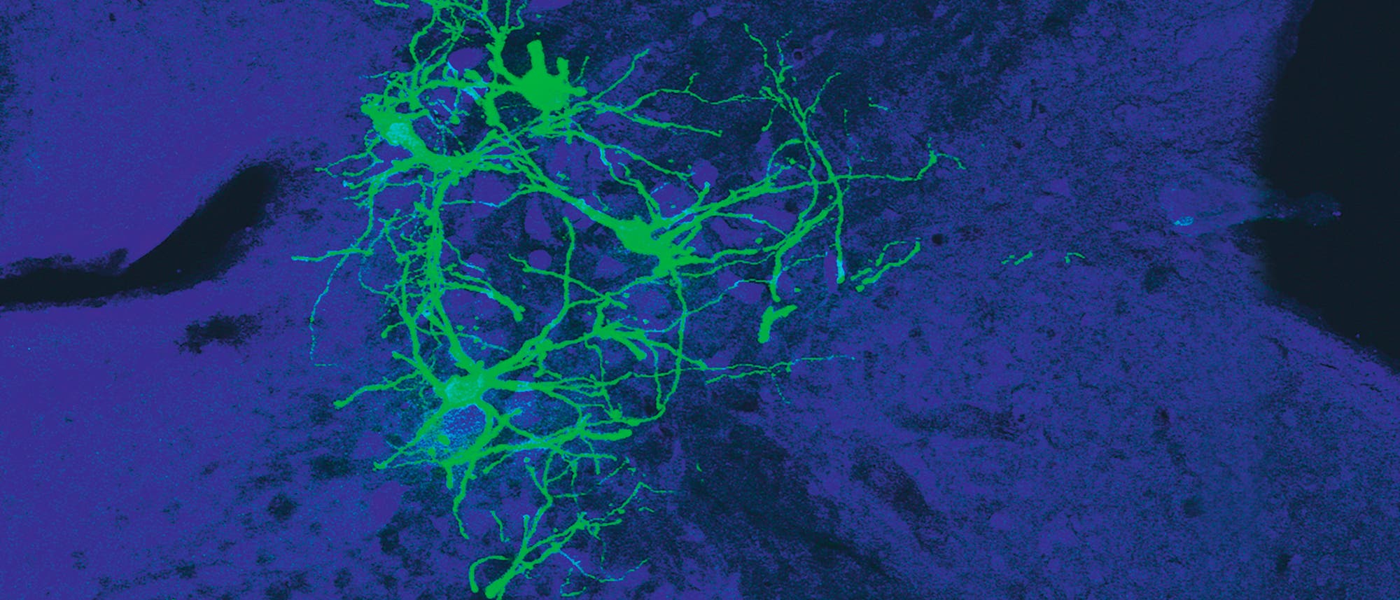 Das Bild zeigt den lateralen vestibulären Nukleus im Hirnstamm einer Maus. Die grün leuchtenden Neurone sind mit einem gentechnisch veränderten Tollwutvirus infiziert. 