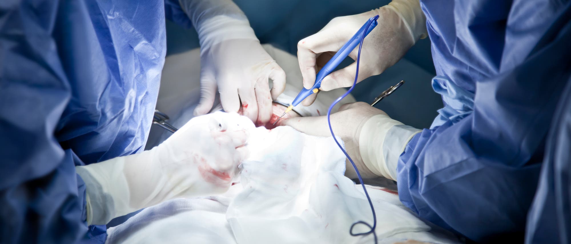 Ärzte operieren mit einem Laser am Unterleib