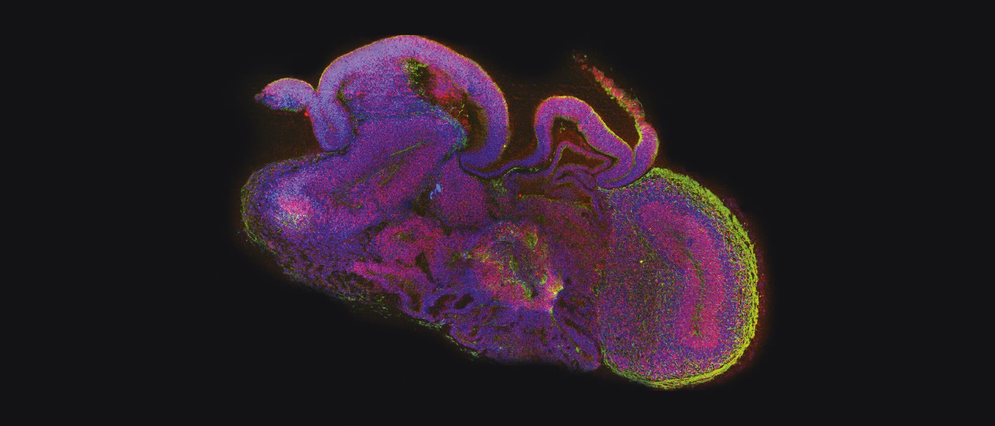 Fluoreszenzmikroskopische Aufnahme eines Minihirns