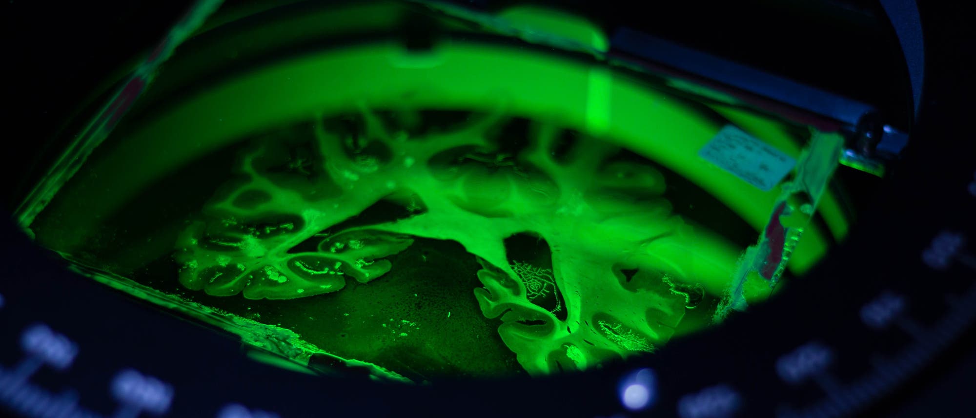Fluoreszenzmikroskopisches Bild einer biologischen Probe, die in leuchtendem Gr&uuml;n erscheint. Die Struktur zeigt verzweigte Muster, die m&ouml;glicherweise Zellen oder Gewebe darstellen. Der Hintergrund ist dunkel, um den Kontrast zur fluoreszierenden Probe zu erh&ouml;hen. Das Bild wird von einem kreisf&ouml;rmigen Rahmen umgeben, der Teil des Mikroskops ist.