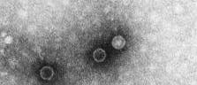Polio virus