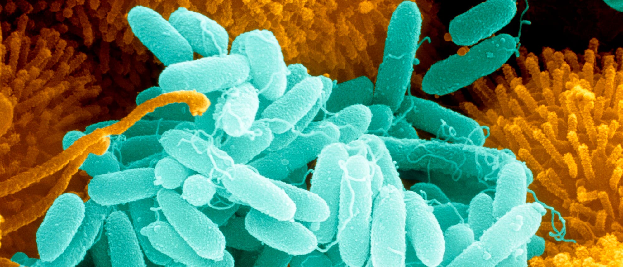 Mikroskopische Aufnahme von blau gefärbten, stäbchenförmigen Bakterien auf einer orangefarbenen, strukturierten Oberfläche. Die Bakterien sind dicht angeordnet und zeigen feine Details ihrer Zellstruktur. Die orangefarbene Oberfläche könnte eine biologische Struktur wie Gewebe oder eine Zelloberfläche darstellen. Mikroskopische Aufnahme von blau gefärbten, stäbchenförmigen Bakterien auf einer orangefarbenen, strukturierten Oberfläche. Die Bakterien sind dicht angeordnet und zeigen feine Details ihrer Zellstruktur. Die orangefarbene Oberfläche könnte eine biologische Struktur wie Gewebe oder eine Zelloberfläche darstellen.
