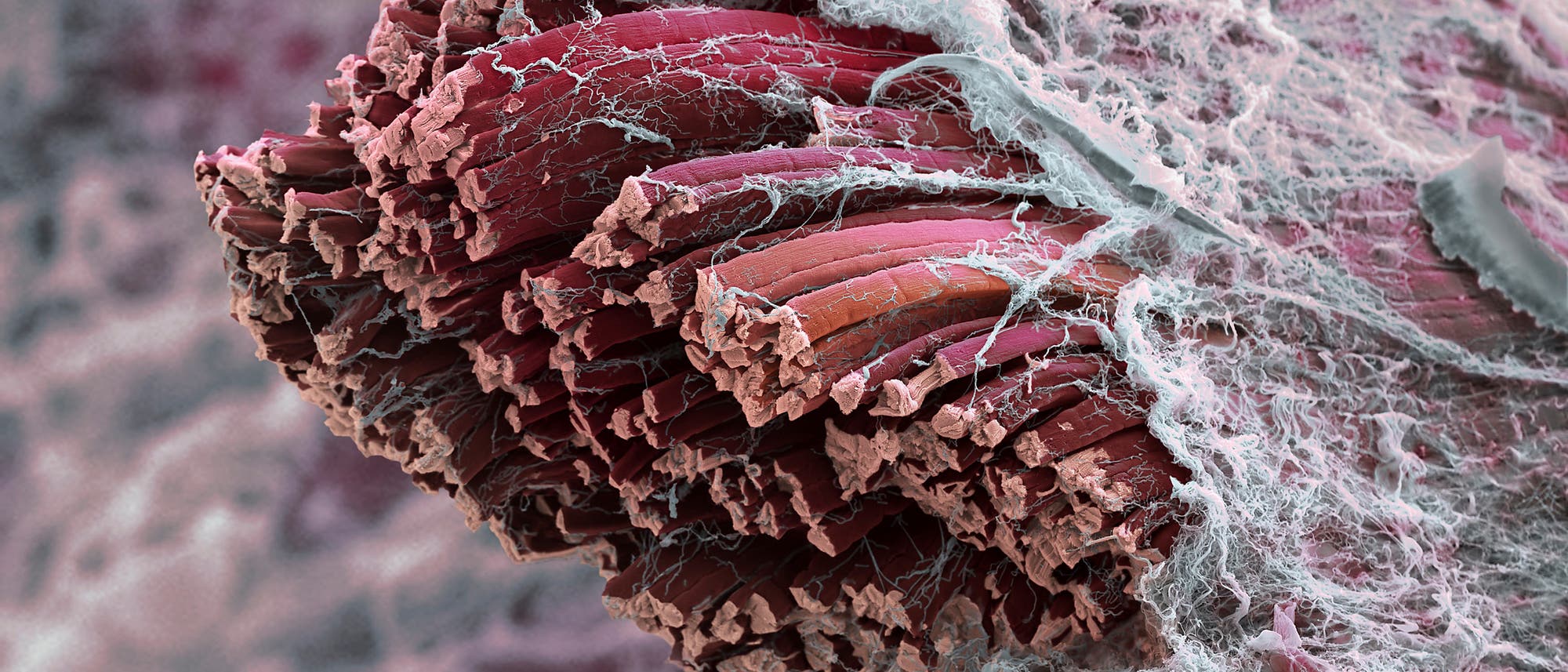 Nahaufnahme eines Muskelgewebes unter einem Mikroskop. Die Struktur zeigt gebündelte, rötliche Muskelfasern, die von einem Netz aus weißen, faserigen Strukturen umgeben sind. Die Textur ist detailliert und komplex, was die feine Beschaffenheit des Gewebes verdeutlicht. Nahaufnahme eines Muskelgewebes unter einem Mikroskop. Die Struktur zeigt gebündelte, rötliche Muskelfasern, die von einem Netz aus weißen, faserigen Strukturen umgeben sind. Die Textur ist detailliert und komplex, was die feine Beschaffenheit des Gewebes verdeutlicht.