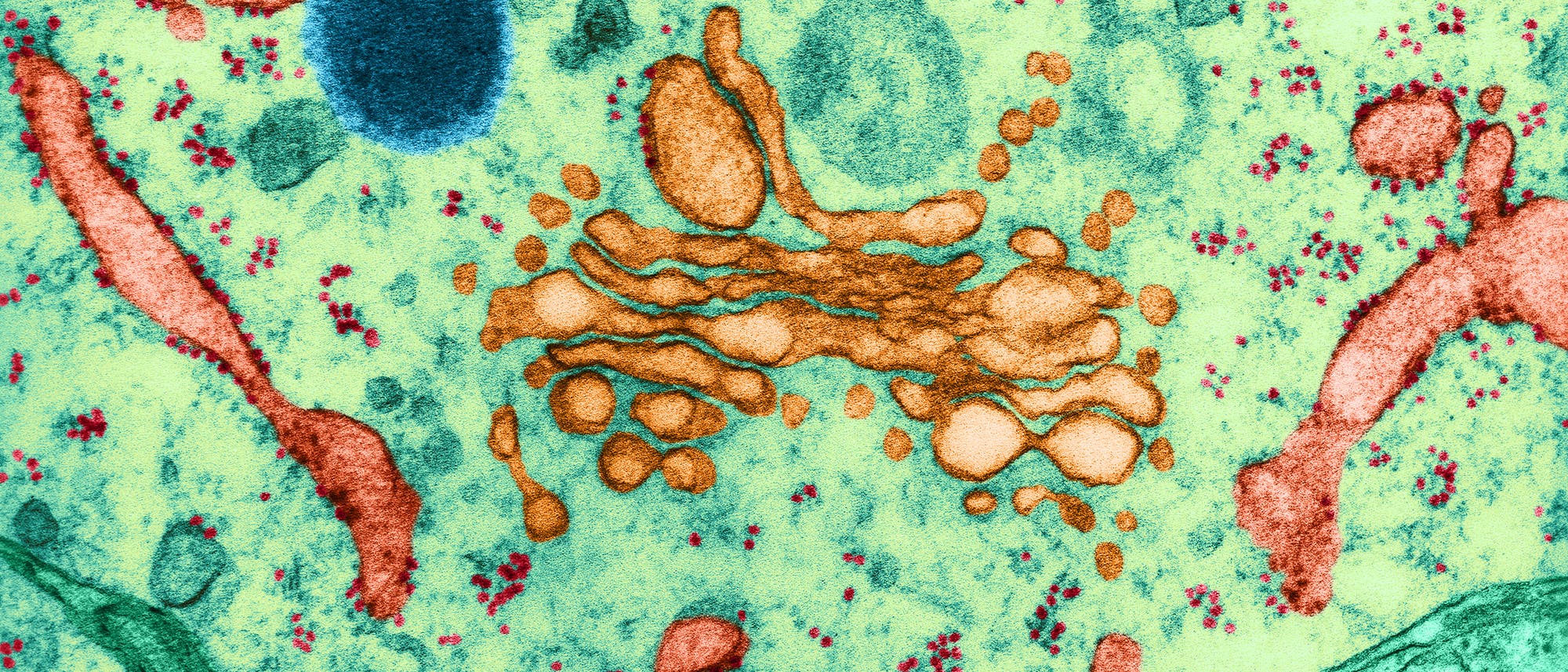 Elektronenmikroskopisches Bild einer Zelle, das verschiedene Zellstrukturen in unterschiedlichen Farben zeigt. Im Zentrum befindet sich ein komplexes, orangefarbenes Netzwerk, das den Golgi-Apparat darstellt. Umgeben ist es von blauen und grünen Bereichen, die Mitochondrien und andere Organellen darstellen könnten. Kleine rote Punkte sind gleichmäßig verteilt und könnten Ribosomen darstellen. Der Hintergrund ist hellgrün, was den zellulären Kontext hervorhebt. Das Bild veranschaulicht die komplexe Struktur und Organisation innerhalb einer Zelle.