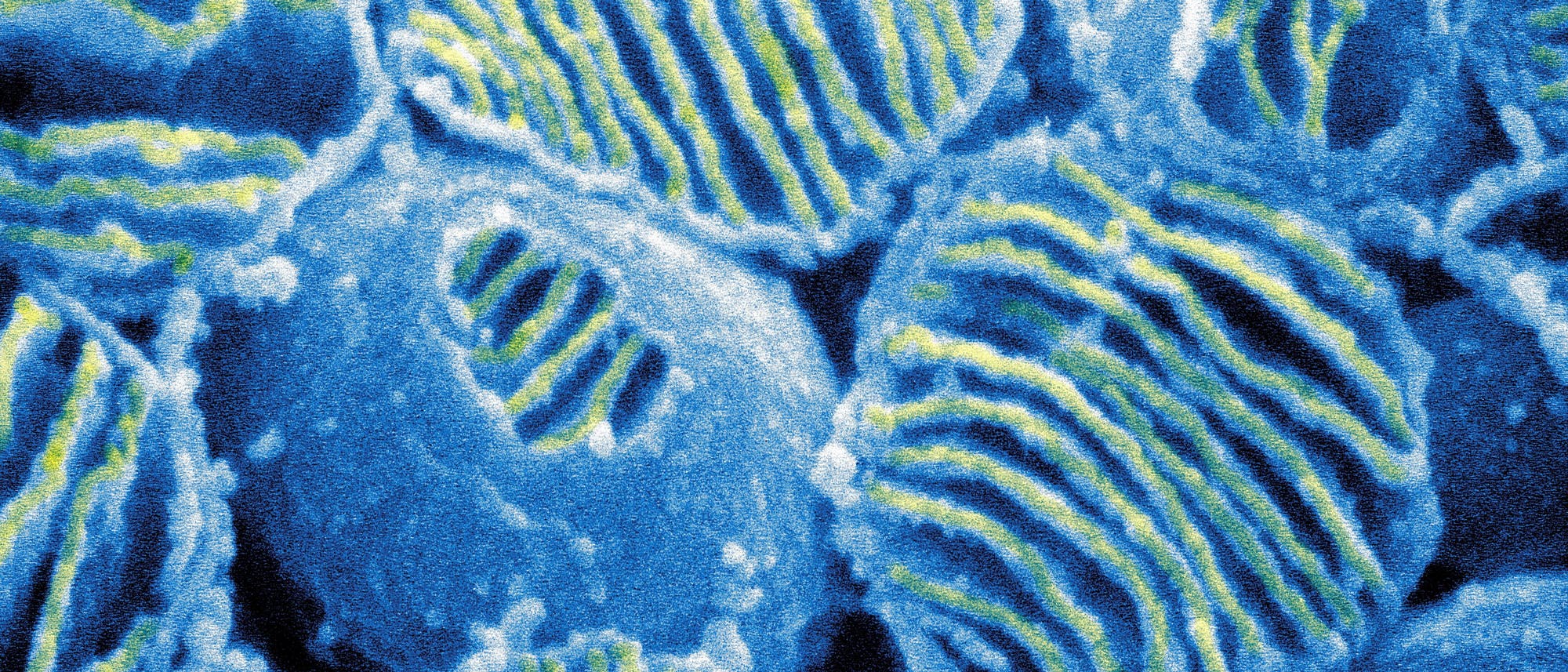 Elektronenmikroskopische Aufnahme von Pflanzenzellen, die in blauen und gelben Tönen dargestellt sind. Die Zellen zeigen eine strukturierte Oberfläche mit parallelen Linien und Mustern, die die Zellwände und innere Strukturen hervorheben. Die Vergrößerung bietet detaillierte Einblicke in die mikroskopische Architektur der Zellen. Elektronenmikroskopische Aufnahme von Pflanzenzellen, die in blauen und gelben Tönen dargestellt sind. Die Zellen zeigen eine strukturierte Oberfläche mit parallelen Linien und Mustern, die die Zellwände und innere Strukturen hervorheben. Die Vergrößerung bietet detaillierte Einblicke in die mikroskopische Architektur der Zellen.