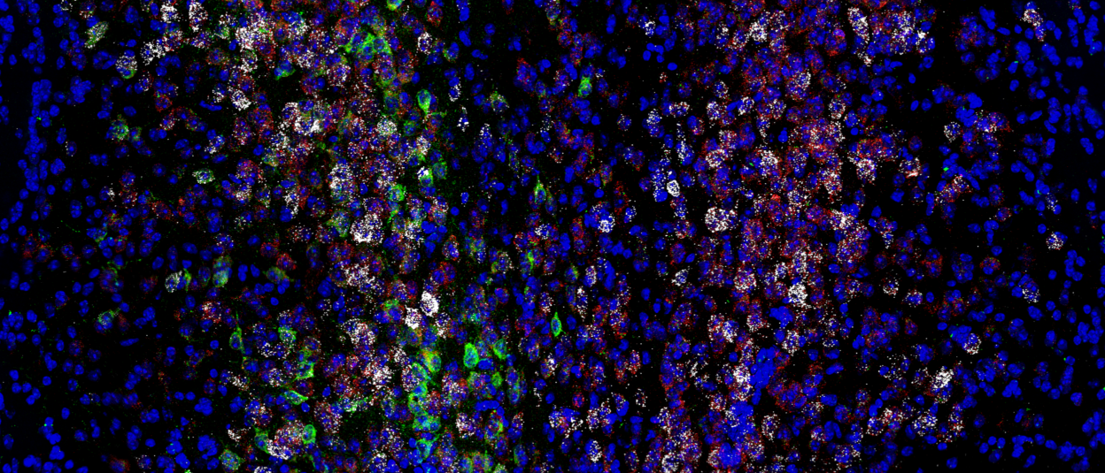 Hirnzellen in bunten Farben