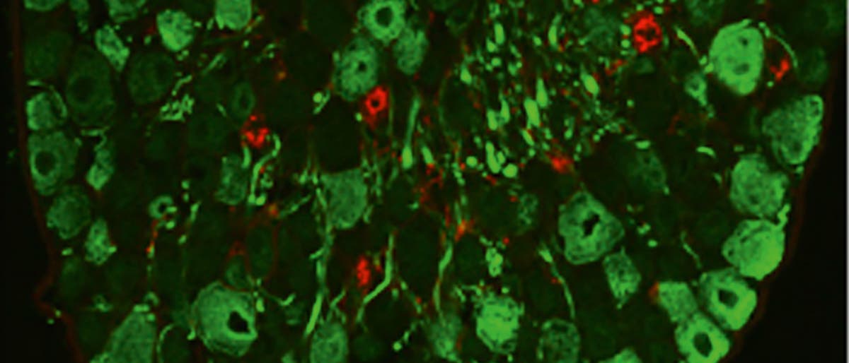 Die kleinen Neurone (rot), die in den Spinalganglien den Juckreiz bei Entzündungen vermitteln, liegen zwischen zahlreichen anderen Nervenzellen (grün).