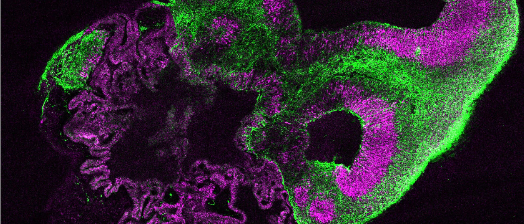 Solche wenige Millimeter großen Gehirnorganoide (hier ein Schnittpräparat) entstehen aus menschlichen pluri- potenten Stammzellen – mit Strukturen, die denen beim Fötus gleichen. Die Farben markieren verschiedene Zellsorten und Hirnbereiche, rechts etwa erkennt man Strukturen einer Großhirnrinde. Neuronale Vorläuferzellen sind rot, Neurone grün.
