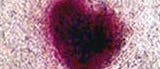Induzierte pluripotente Stammzellen