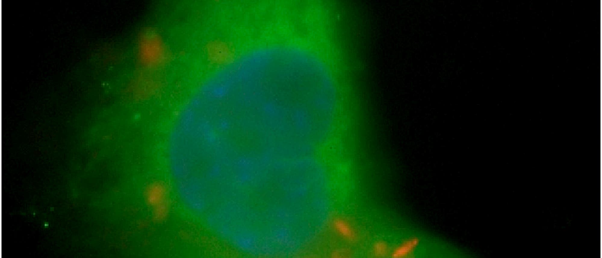 Mycobacterium in einer Knochenmarkstammzelle