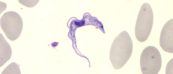 Trypanosoma Parasit im Mikroskop