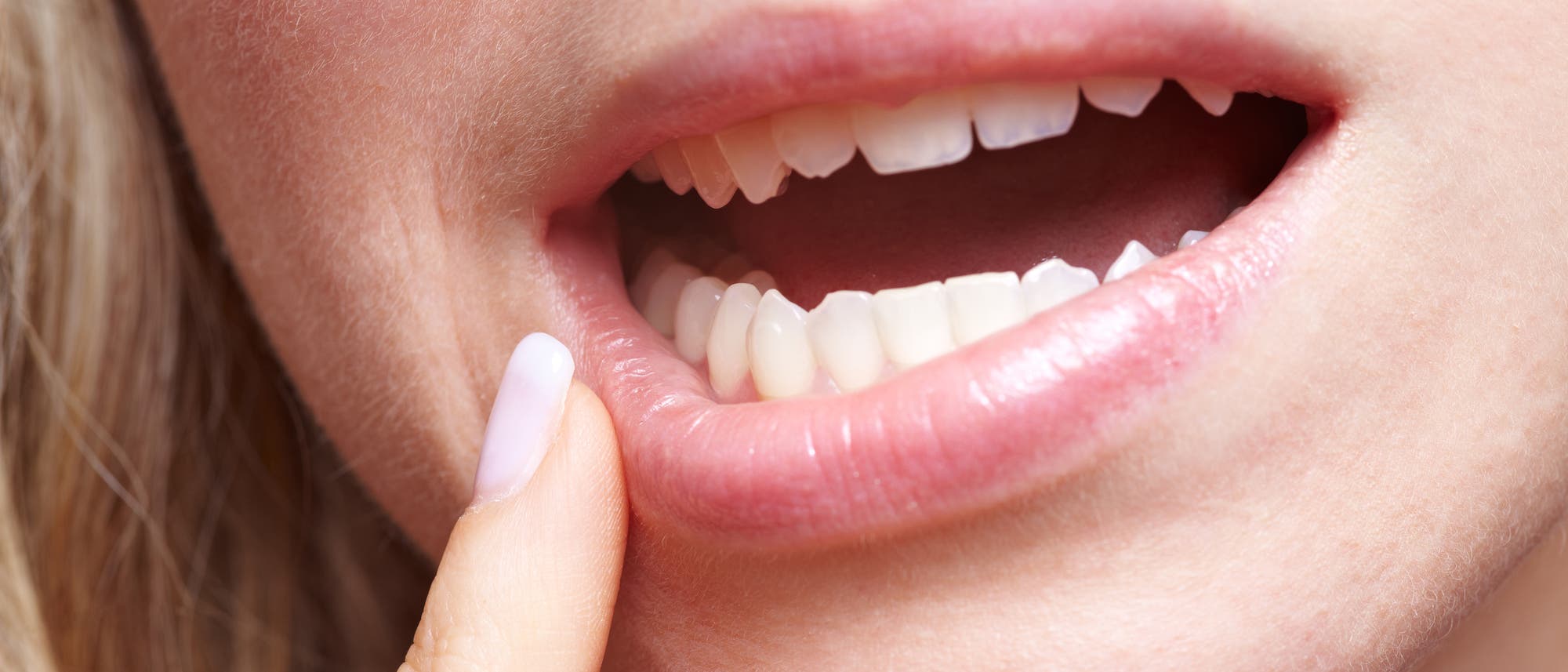 Frau mit Zahnfleischschmerzen