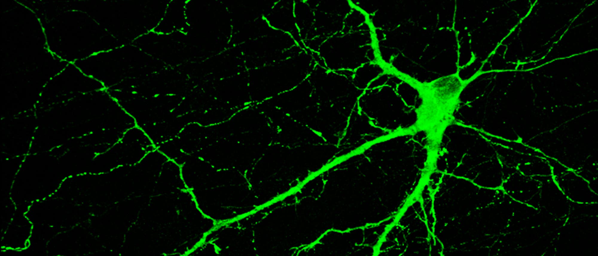 Markiertes Neuron